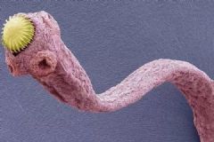 女子体内取出13厘米长的活虫！这种傻事可别再做了[多图]