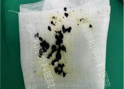 1760692641359288.png image.png