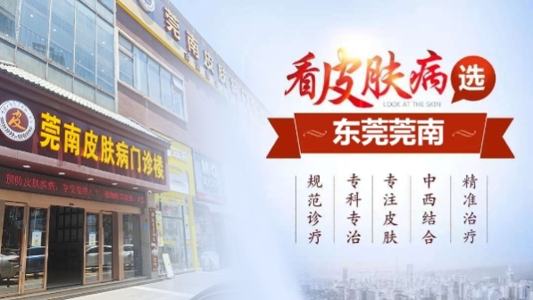 东莞莞南皮肤病医院怎么样？实在疗效赢得青睐